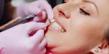 Byte Aligners Lawsuit: What Every Buyer Should Understand