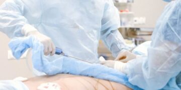 Hernia Mesh Lawsuit Update 2026: Settlements and news